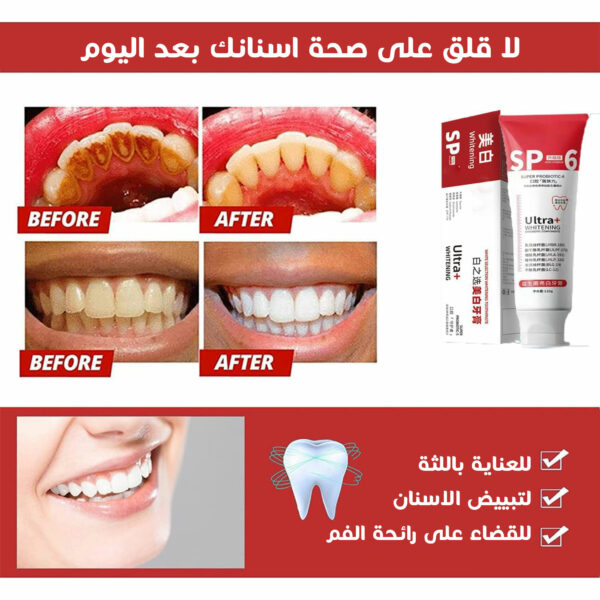 ⁦عرض حبتيين معجون اسنان SP6⁩ - الصورة ⁦2⁩