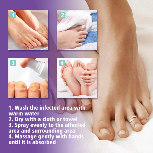 ⁦• NAIL FANGUS SPRAY⁩ - الصورة ⁦6⁩