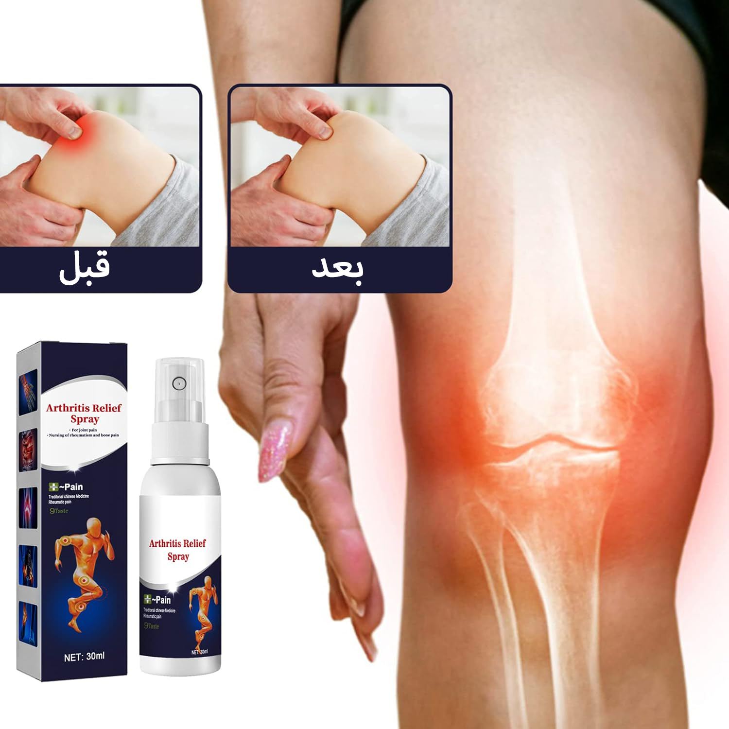 • سبراي المفاصل السحري - الصورة 2