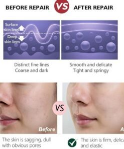 Retinol cream (Anti-Aging)