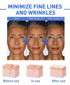 Botox Alternative set