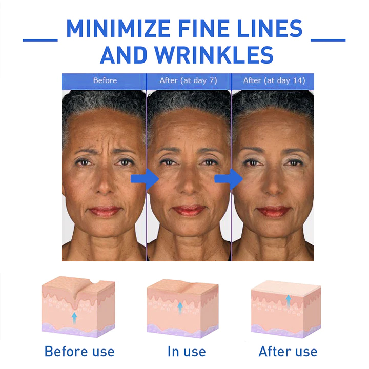 Botox Alternative set