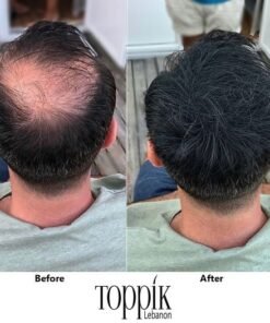 عرض عبوتين Toppik Hair Fibers لفراغات الشعر ( اللون اسود )