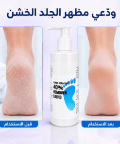 Callus remover gel 250ML