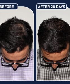 عرض سيرم Blue PePtide + سبراي الشعر FEG