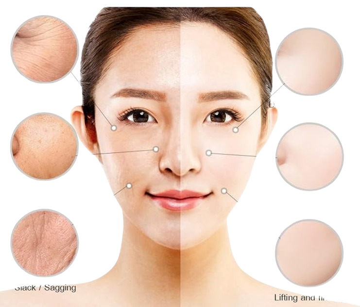 Retinol cream (Anti-Aging)