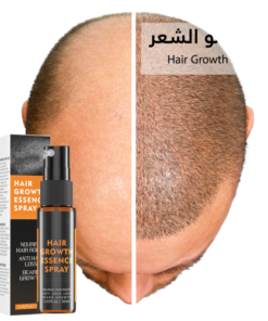 Hair Growth Spray بخاخ نمو الشعر