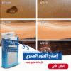 اصلاح الجلود السحرى