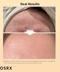 • CORSX Snail serum