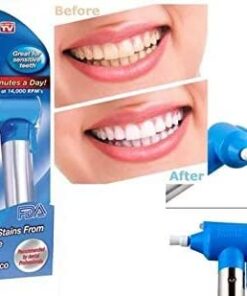 اداة تبييض الاسنان smile