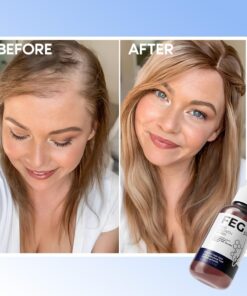 عرض سيرم Blue PePtide + سبراي الشعر FEG